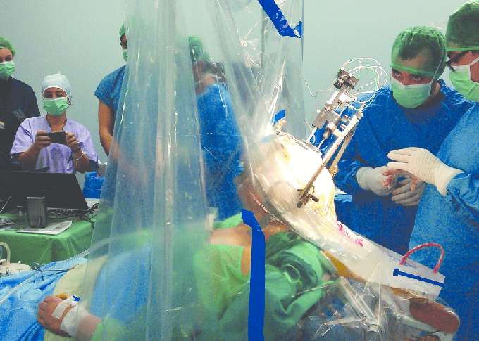 COMPREHENSIVE GUIDE TO ANESTHETIC MANAGEMENT AND PERIOPERATIVE COMPLICATIONS IN DEEP BRAIN STIMULATION (DBS) SURGERY