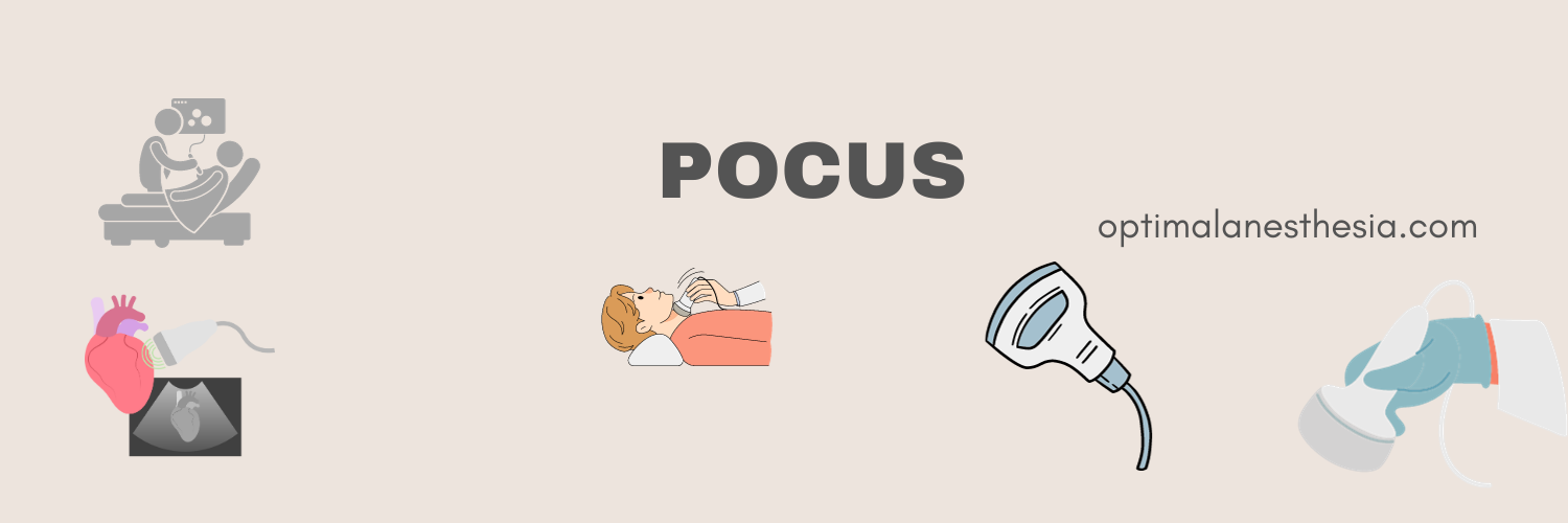 Perioperative Point-of-Care Ultrasound (POCUS)