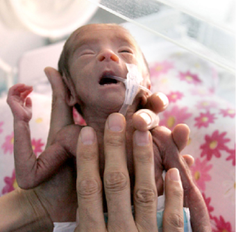 Anaesthetic Challenges in preterm babies