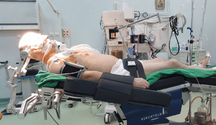 Neurosurgical Patient Positions: Complications and Preventive Measures for Safer Surgery