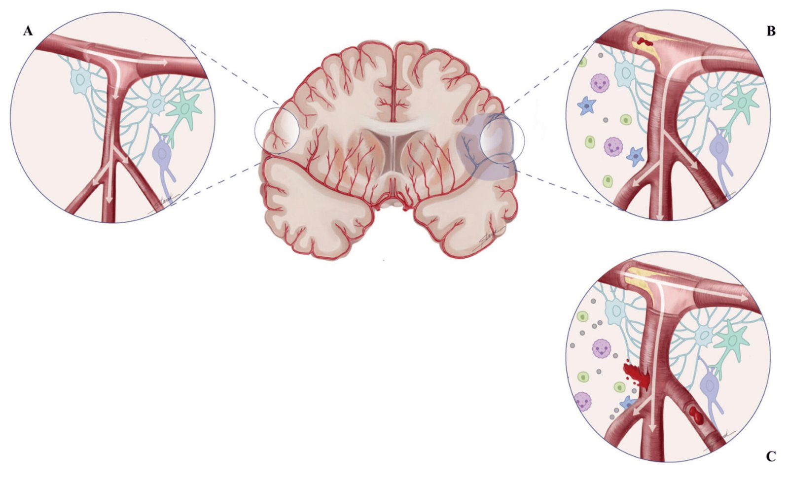 Cerebral Autoregulation in Health and Disease: Insights from an Anesthesiologist
