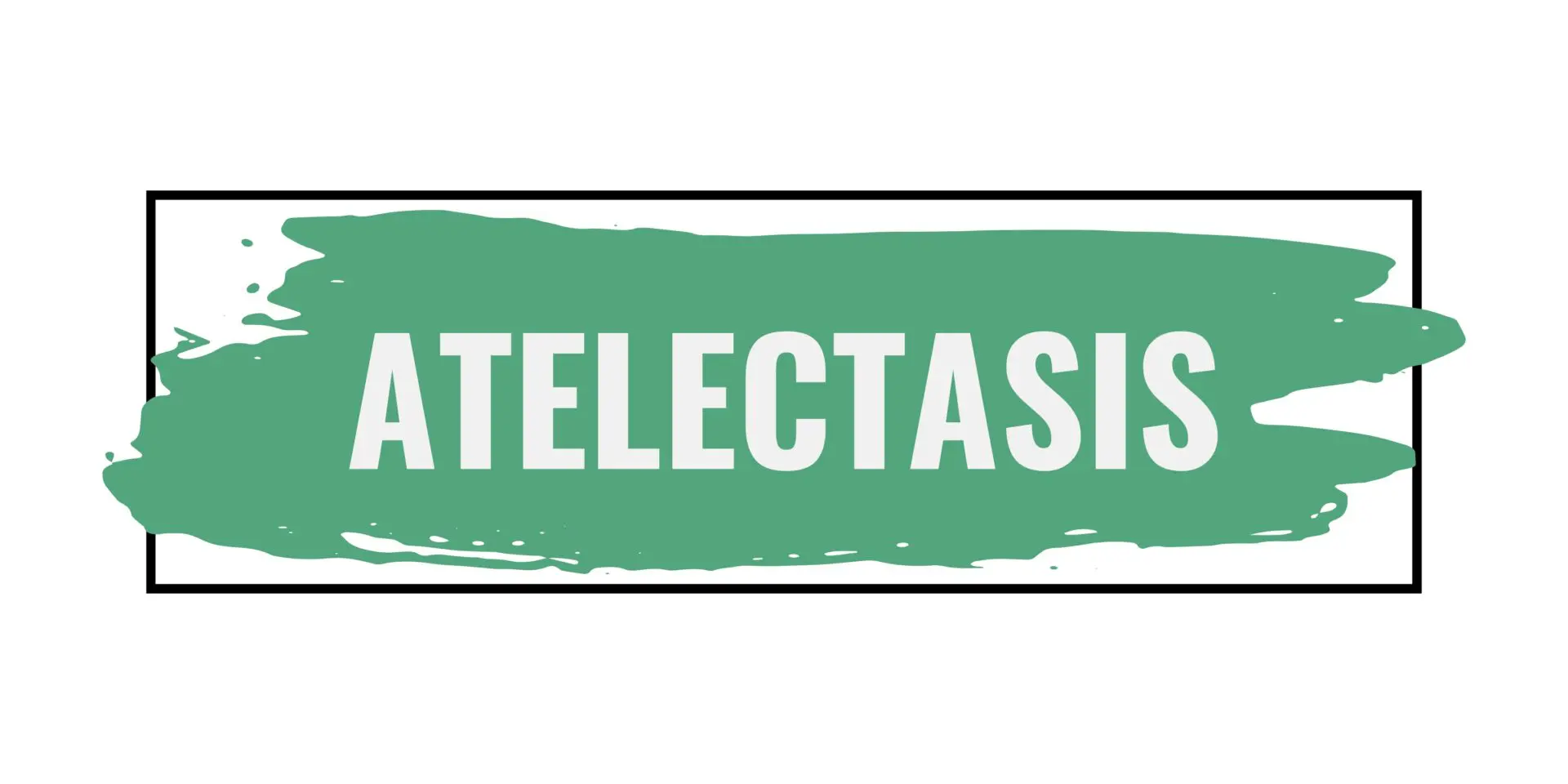Comprehensive Review of Atelectasis: Mechanisms, Diagnosis, Risk Factors, Prevention, and Management